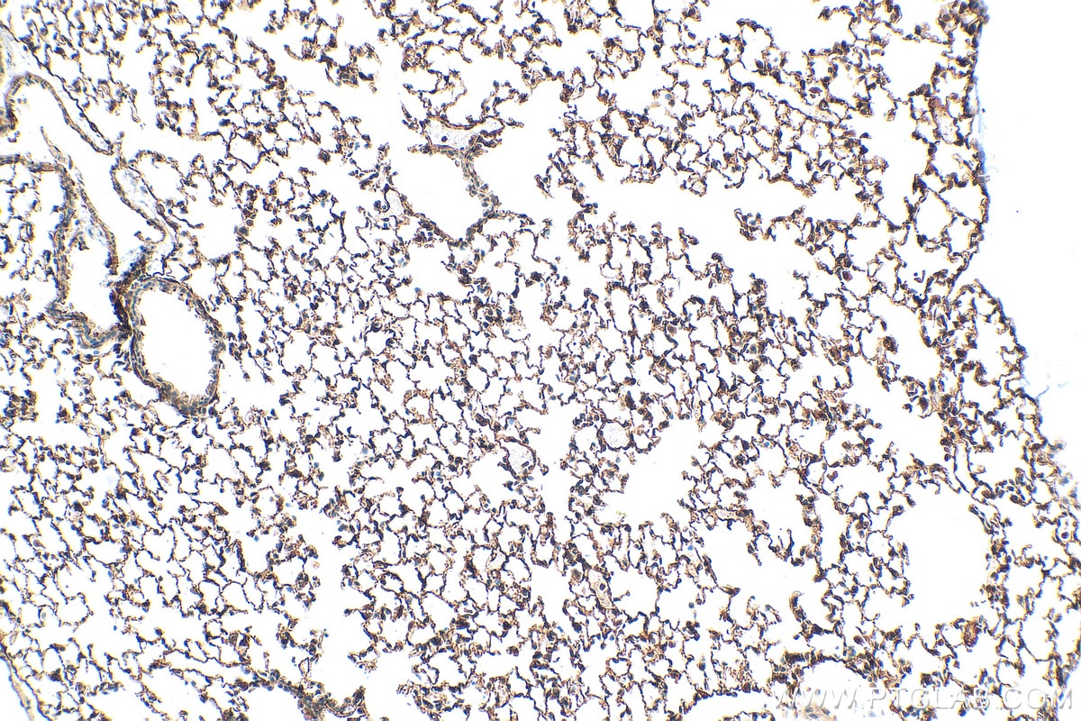 Immunohistochemistry (IHC) staining of mouse lung tissue using Integrin alpha-8 Polyclonal antibody (30714-1-AP)