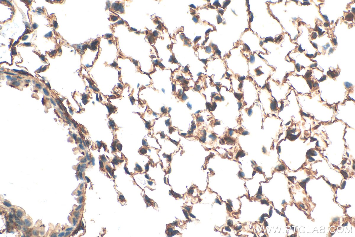 Immunohistochemistry (IHC) staining of mouse lung tissue using Integrin alpha-8 Polyclonal antibody (30714-1-AP)