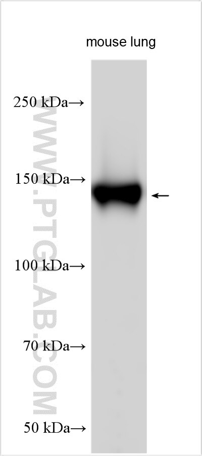 Western Blot (WB) analysis of various lysates using Integrin alpha-8 Polyclonal antibody (30714-1-AP)