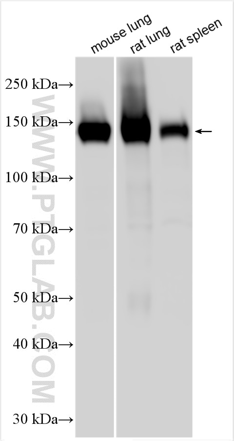 Western Blot (WB) analysis of various lysates using Integrin alpha-8 Polyclonal antibody (30714-1-AP)