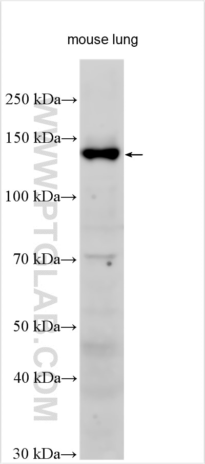 Western Blot (WB) analysis of various lysates using Integrin alpha-8 Polyclonal antibody (55068-1-AP)