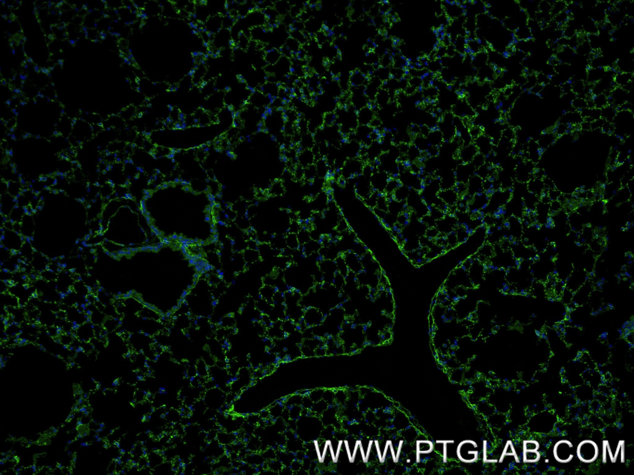 IF Staining of mouse lung using 87408-1-RR Immunofluorescence (IF) / fluorescent staining of mouse lung tissue using Integrin alpha-8 Recombinant monoclonal antibody (87408-1-RR)
