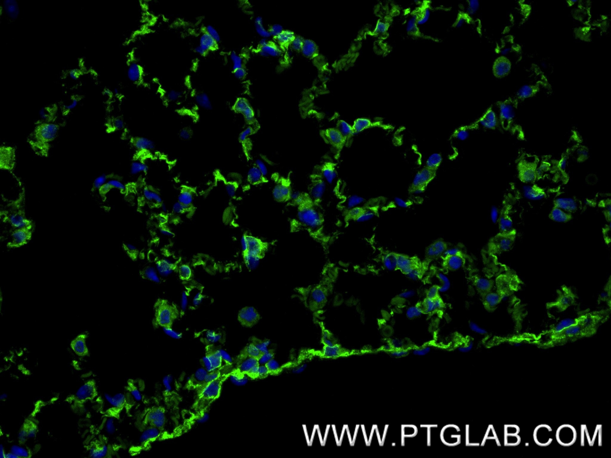 IF Staining of mouse lung using 87408-1-RR Immunofluorescence (IF) / fluorescent staining of mouse lung tissue using Integrin alpha-8 Recombinant monoclonal antibody (87408-1-RR)