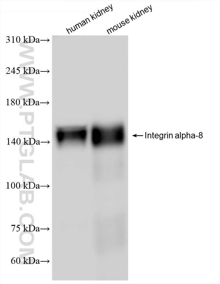 WB analysis using 87408-1-RR Western Blot (WB) analysis of various lysates using Integrin alpha-8 Recombinant monoclonal antibody (87408-1-RR)