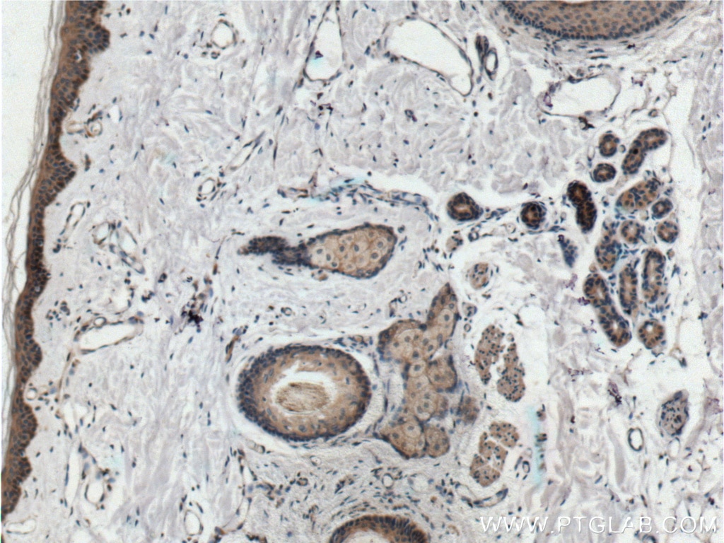 Immunohistochemistry (IHC) staining of human skin tissue using Integrin Beta 1 Polyclonal antibody (26918-1-AP)