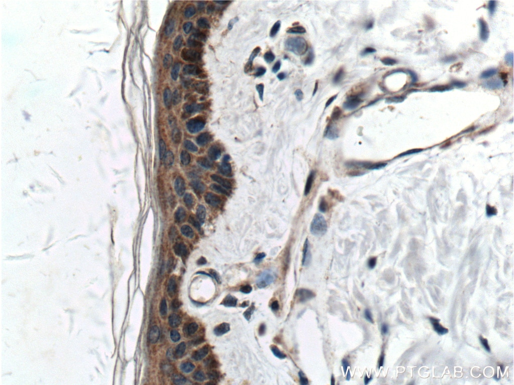 Immunohistochemistry (IHC) staining of human skin tissue using Integrin Beta 1 Polyclonal antibody (26918-1-AP)