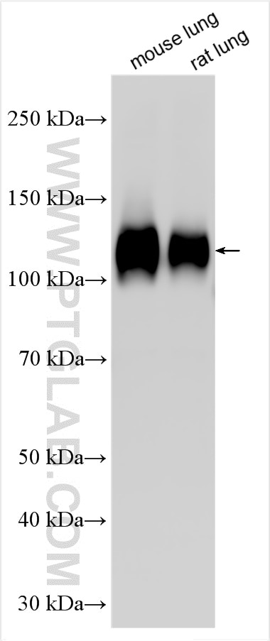 Western Blot (WB) analysis of various lysates using Integrin Beta 1 Polyclonal antibody (26918-1-AP)