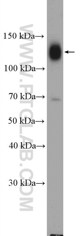 Western Blot (WB) analysis of HT-1080 cells using Integrin Beta 1 Polyclonal antibody (26918-1-AP)