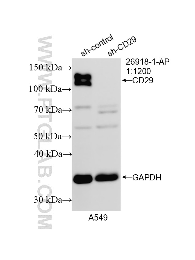 Western Blot (WB) analysis of A549 cells using Integrin Beta 1/CD29 Polyclonal antibody (26918-1-AP)
