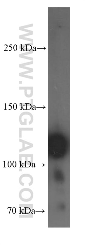 Western Blot (WB) analysis of HT-1080 cells using Integrin Beta 1 Monoclonal antibody (66315-1-Ig)