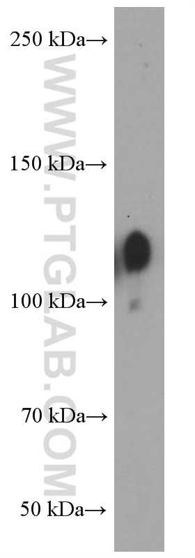 Western Blot (WB) analysis of HT-1080 cells using Integrin Beta 1 Monoclonal antibody (66315-1-Ig)