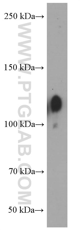 Integrin Beta 1 Monoclonal antibody