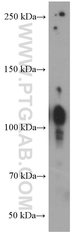Western Blot (WB) analysis of HUVEC cells using Integrin Beta 1 Monoclonal antibody (66315-1-Ig)