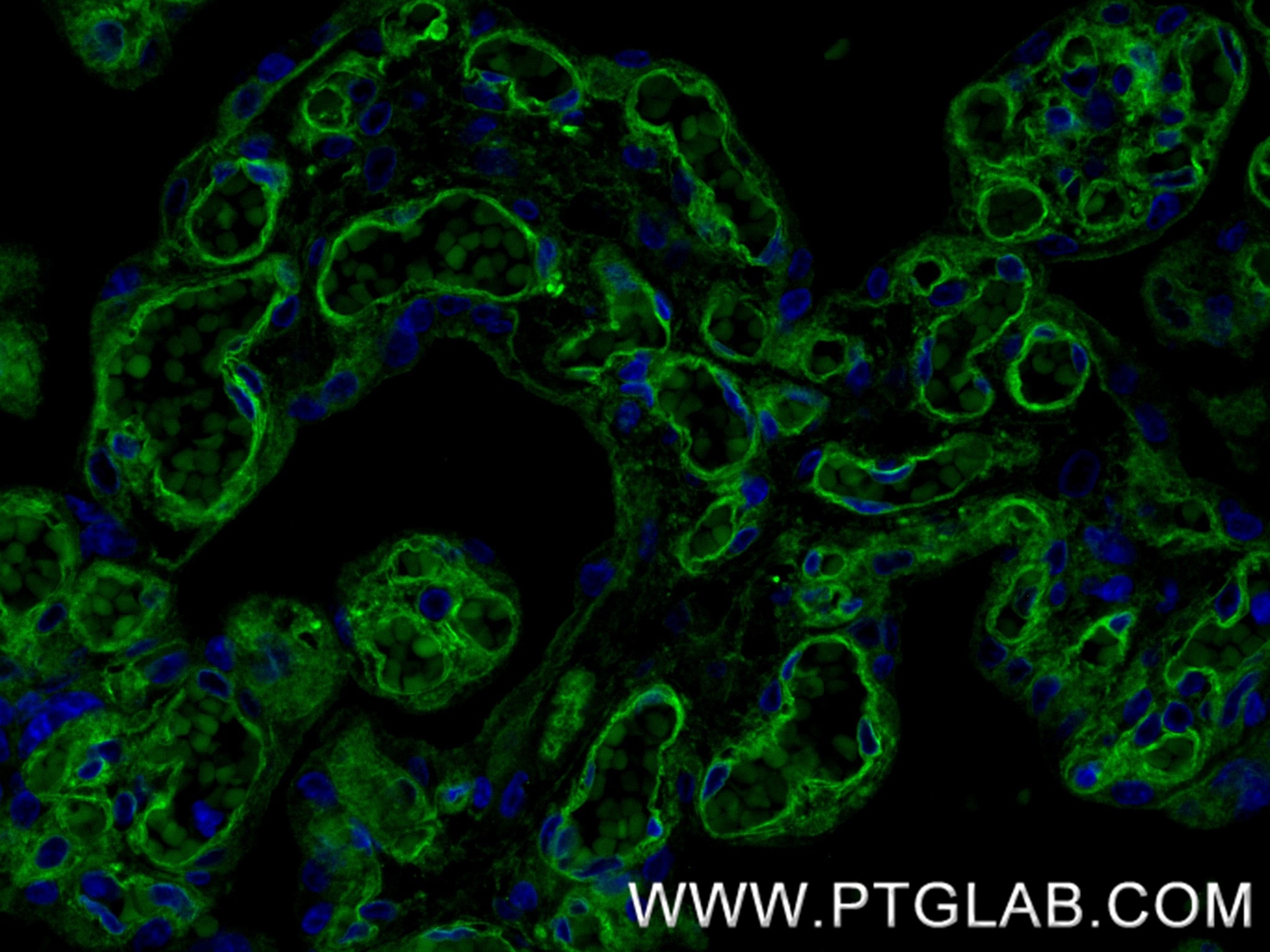 Immunofluorescent analysis of (4% PFA) fixed paraffin-embedded human placenta tissue using Integrin Beta 1/CD29 antibody (82729-3-RR, Clone: 1K20 ) at dilution of 1:200 and CoraLite®488-Conjugated Goat Anti-Rabbit IgG(H+L) (SA00013-2). Heat mediated antigen retrieval with Tris-EDTA buffer (pH 9.0). Immunofluorescence (IF) / fluorescent staining of human placenta tissue using Integrin Beta 1/CD29 Recombinant monoclonal antibo (82729-3-RR)