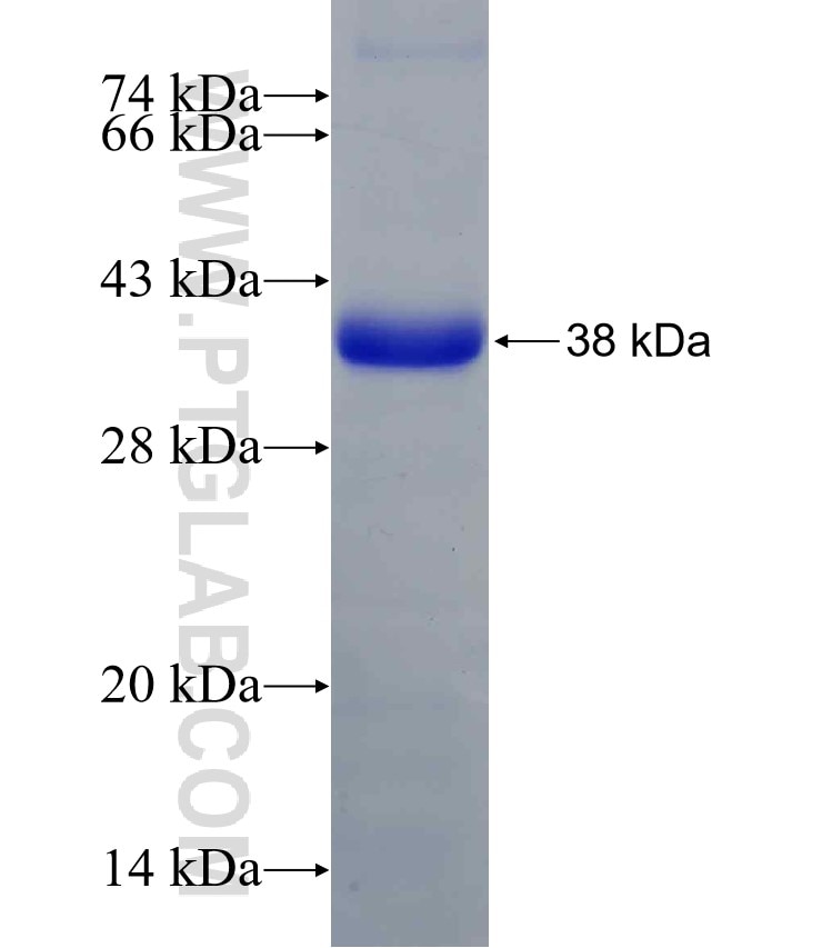 Integrin beta-1 fusion protein Ag24476 SDS-PAGE