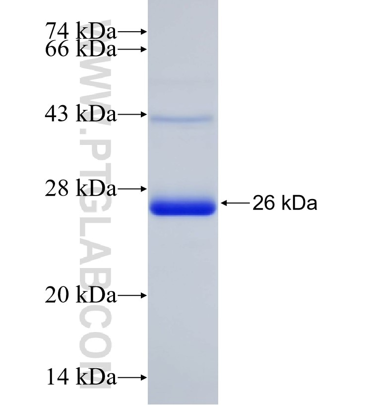 Integrin beta-1 fusion protein Ag25406 SDS-PAGE