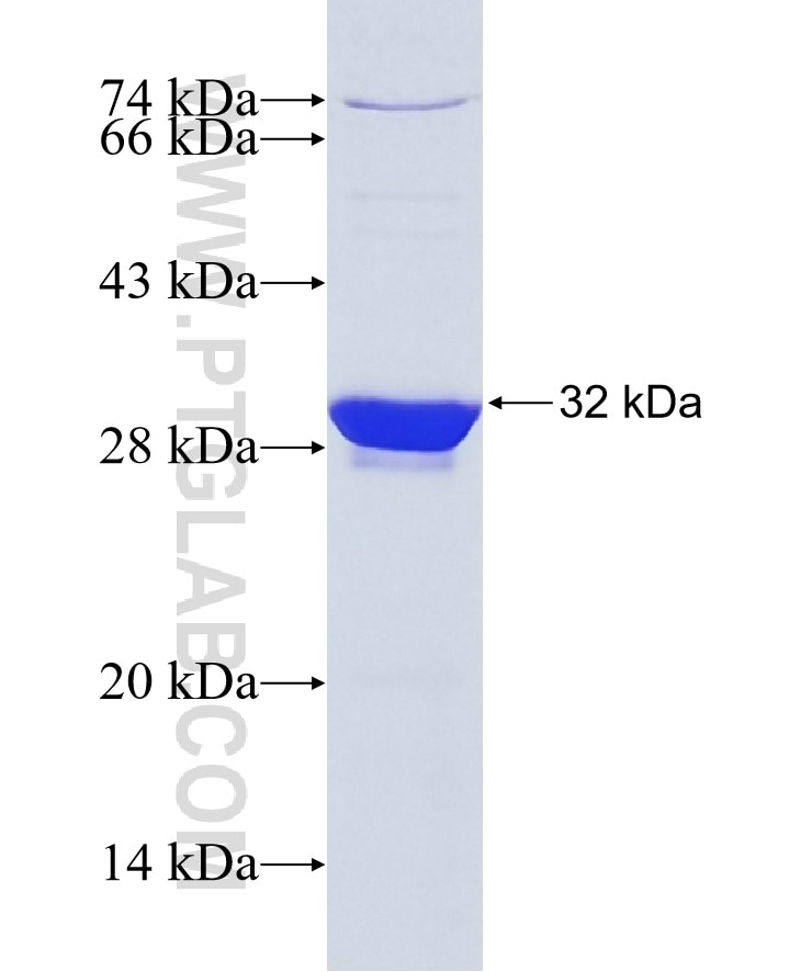 Integrin beta-1 fusion protein Ag25426 SDS-PAGE