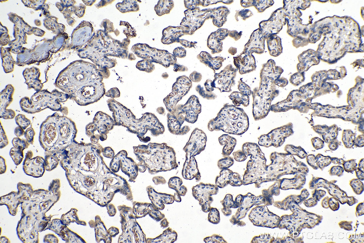 Immunohistochemistry (IHC) staining of human placenta tissue using CD61 / Integrin Beta 3 Monoclonal antibody (66952-1-Ig)