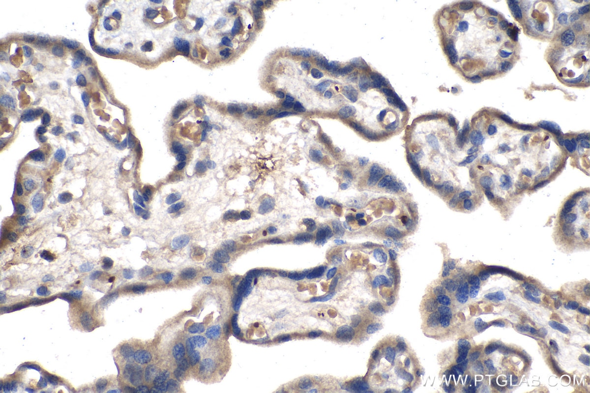 Immunohistochemistry (IHC) staining of human placenta tissue using CD61 / Integrin Beta 3 Monoclonal antibody (66952-1-Ig)