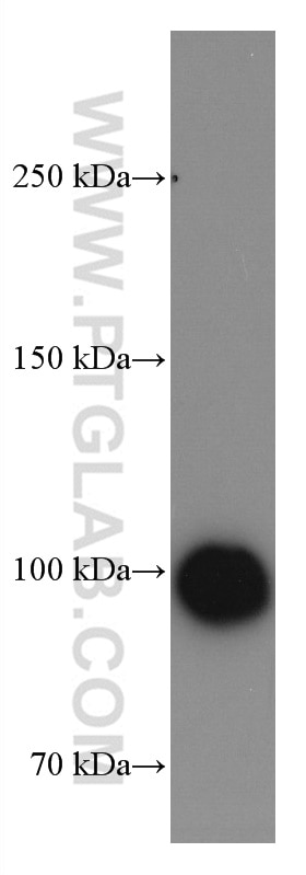 Western Blot (WB) analysis of human placenta tissue using CD61 / Integrin Beta 3 Monoclonal antibody (66952-1-Ig)