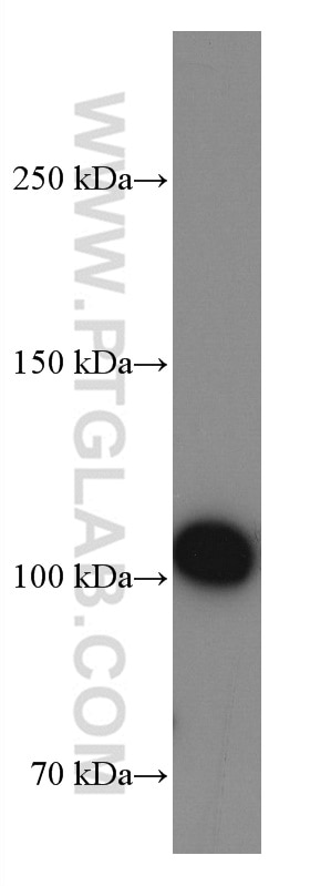 Western Blot (WB) analysis of HUVEC cells using CD61 / Integrin Beta 3 Monoclonal antibody (66952-1-Ig)