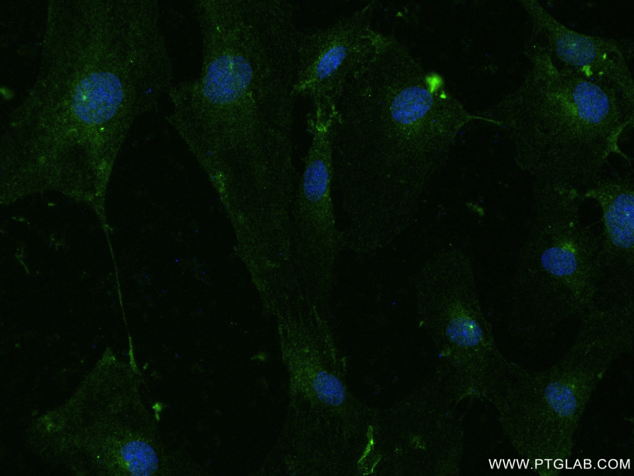 Integrin beta-3