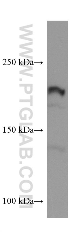 Western Blot (WB) analysis of HeLa cells using Integrin Beta 4 Monoclonal antibody (66922-2-Ig)