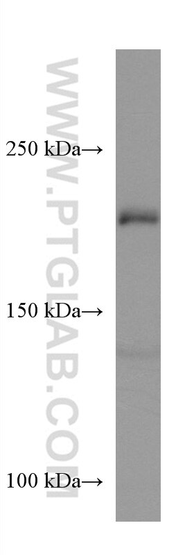 Western Blot (WB) analysis of MCF-7 cells using Integrin Beta 4 Monoclonal antibody (66922-2-Ig)