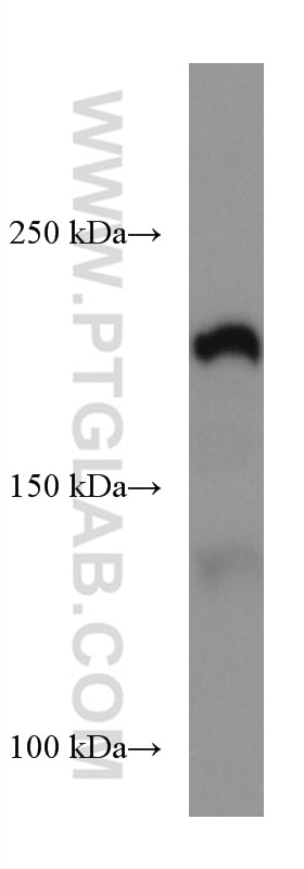 Western Blot (WB) analysis of A549 cells using Integrin Beta 4 Monoclonal antibody (66922-2-Ig)