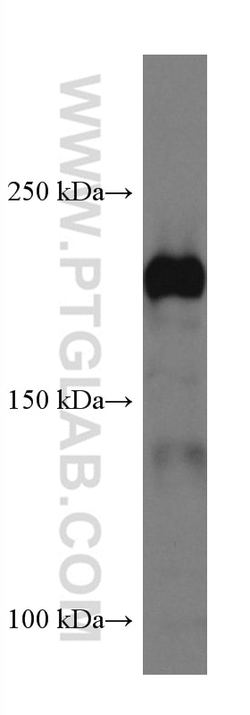 Western Blot (WB) analysis of BxPC-3 cells using Integrin Beta 4 Monoclonal antibody (66922-2-Ig)