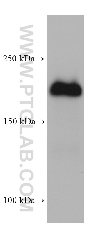 Western Blot (WB) analysis of SW 1990 cells using Integrin Beta 4 Monoclonal antibody (66922-2-Ig)