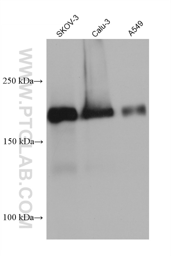 Western Blot (WB) analysis of various lysates using Integrin Beta 4 Monoclonal antibody (66922-2-Ig)
