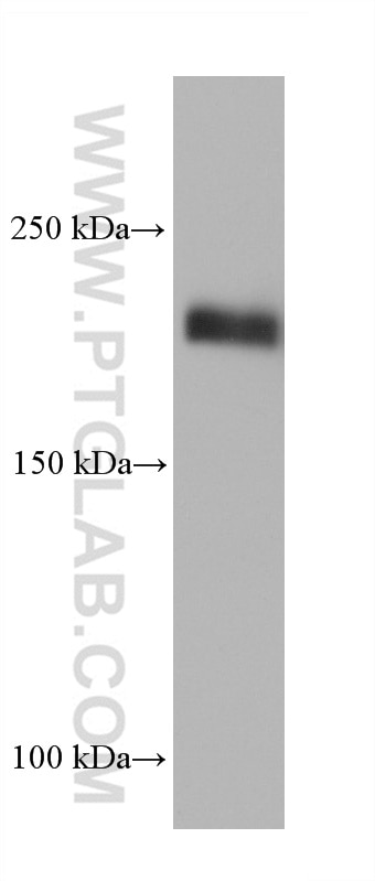 Western Blot (WB) analysis of BxPC-3 cells using Integrin Beta 4 Monoclonal antibody (66922-2-Ig)