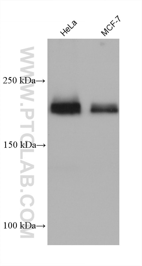 Western Blot (WB) analysis of various lysates using Integrin Beta 4 Monoclonal antibody (66922-2-Ig)