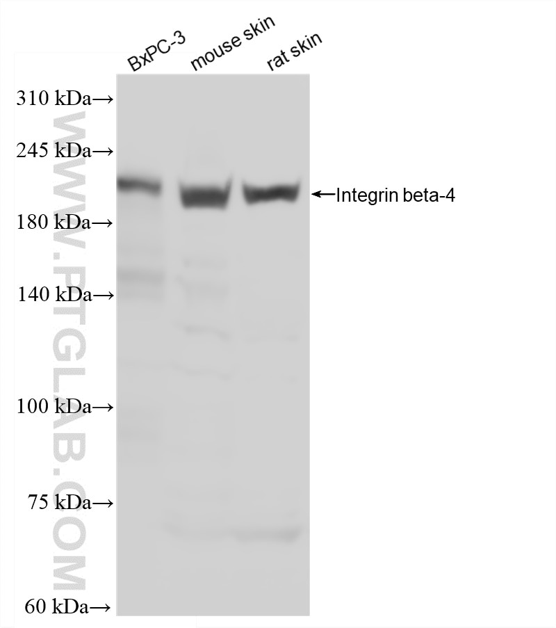 Various lysates were subjected to SDS PAGE followed by western blot with 87416-2-RR (ITB4 antibody) at dilution of 1:1000 incubated at room temperature for 1.5 hours. Western Blot (WB) analysis of various lysates using Integrin beta 4 Recombinant monoclonal antibody (87416-2-RR)