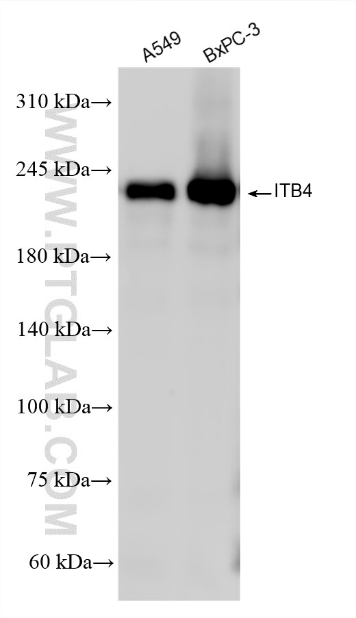 Western Blot (WB) analysis of various lysates using Integrin beta 4 Recombinant monoclonal antibody (87416-5-RR)