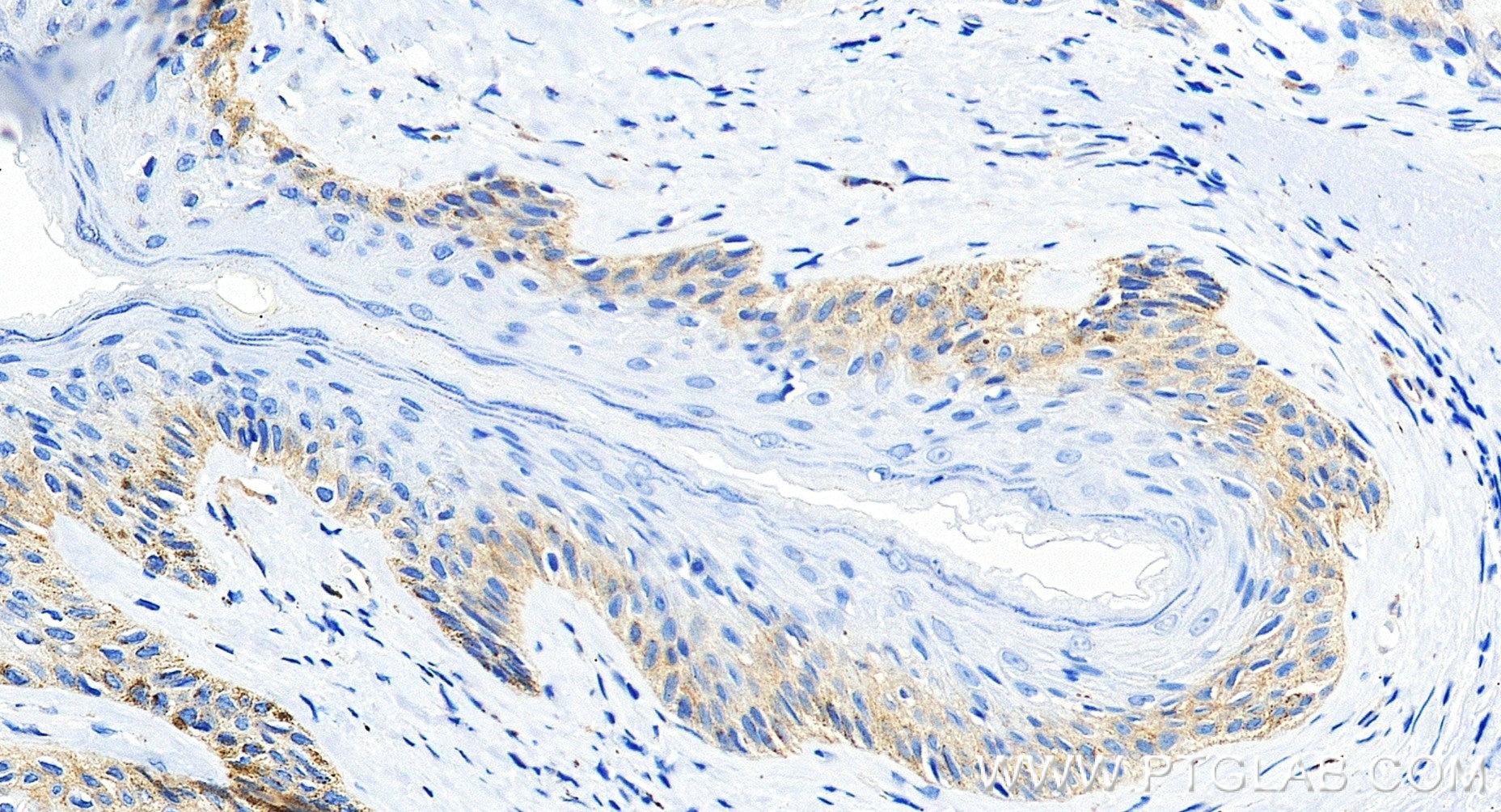Immunohistochemistry (IHC) staining of human skin tissue using Anti-Human Integrin beta 4 Rabbit Recombinant Anti (98774-1-RR)