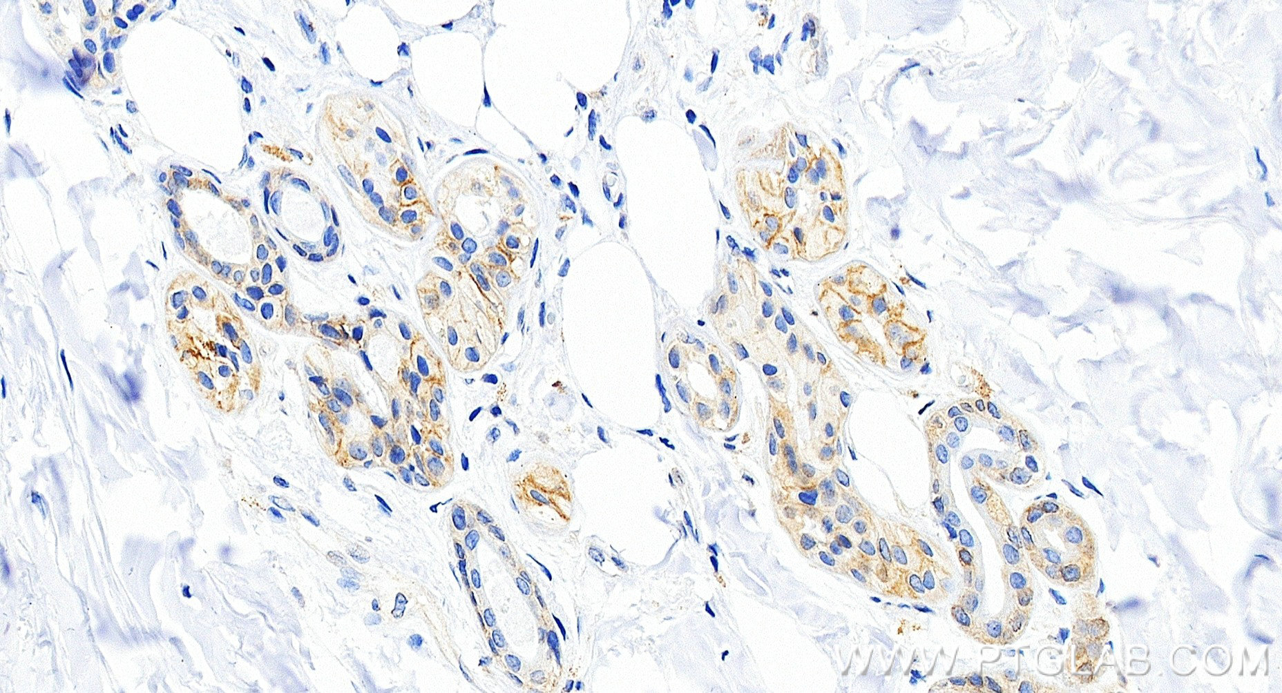 Immunohistochemistry (IHC) staining of human skin tissue using Anti-Human Integrin beta 4 Rabbit Recombinant Anti (98774-1-RR)
