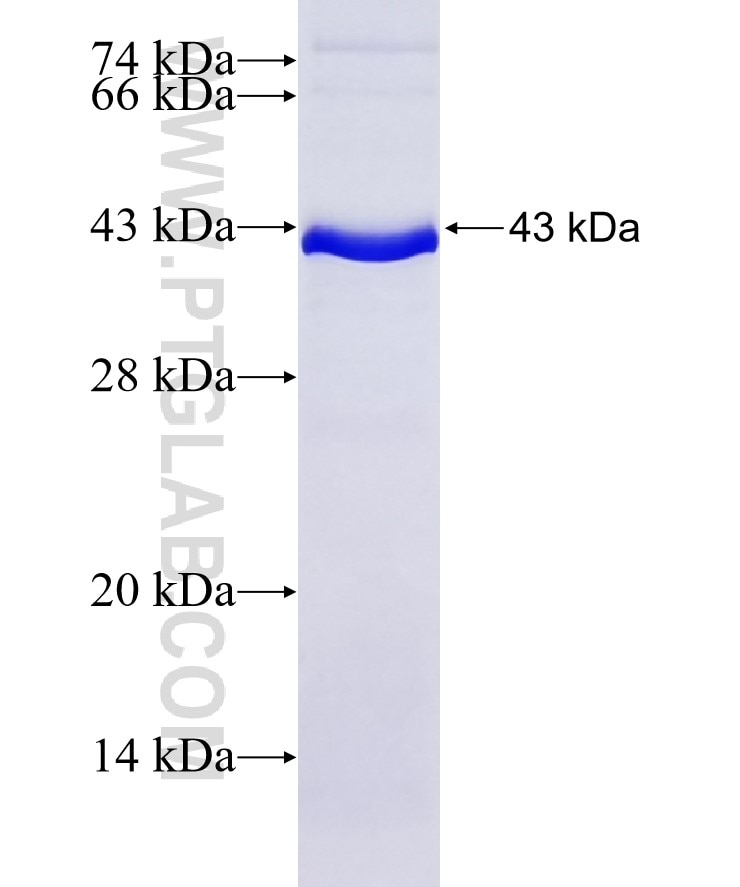 Integrin beta-4 fusion protein Ag17395 SDS-PAGE