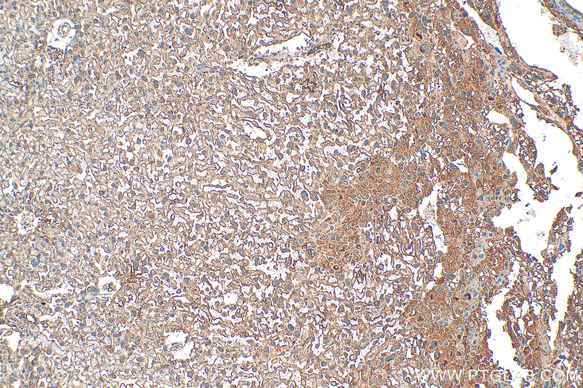 Immunohistochemistry (IHC) staining of mouse placenta tissue using Integrin Beta 5 Polyclonal antibody (28543-1-AP)