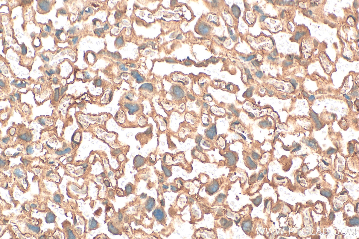 Immunohistochemistry (IHC) staining of mouse placenta tissue using Integrin Beta 5 Polyclonal antibody (28543-1-AP)