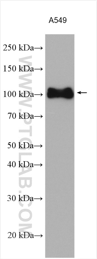 Western Blot (WB) analysis of various lysates using Integrin Beta 5 Polyclonal antibody (28543-1-AP)