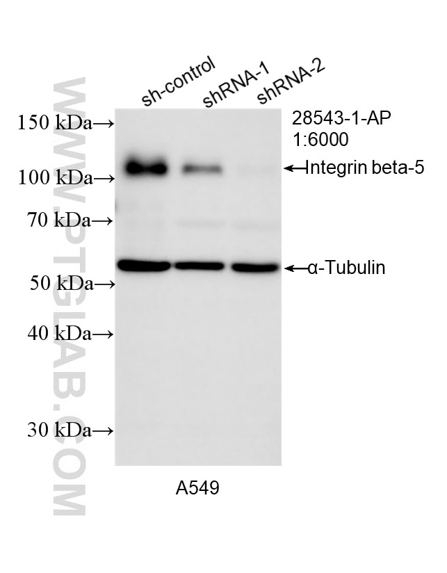 Western Blot (WB) analysis of A549 cells using Integrin Beta 5 Polyclonal antibody (28543-1-AP)