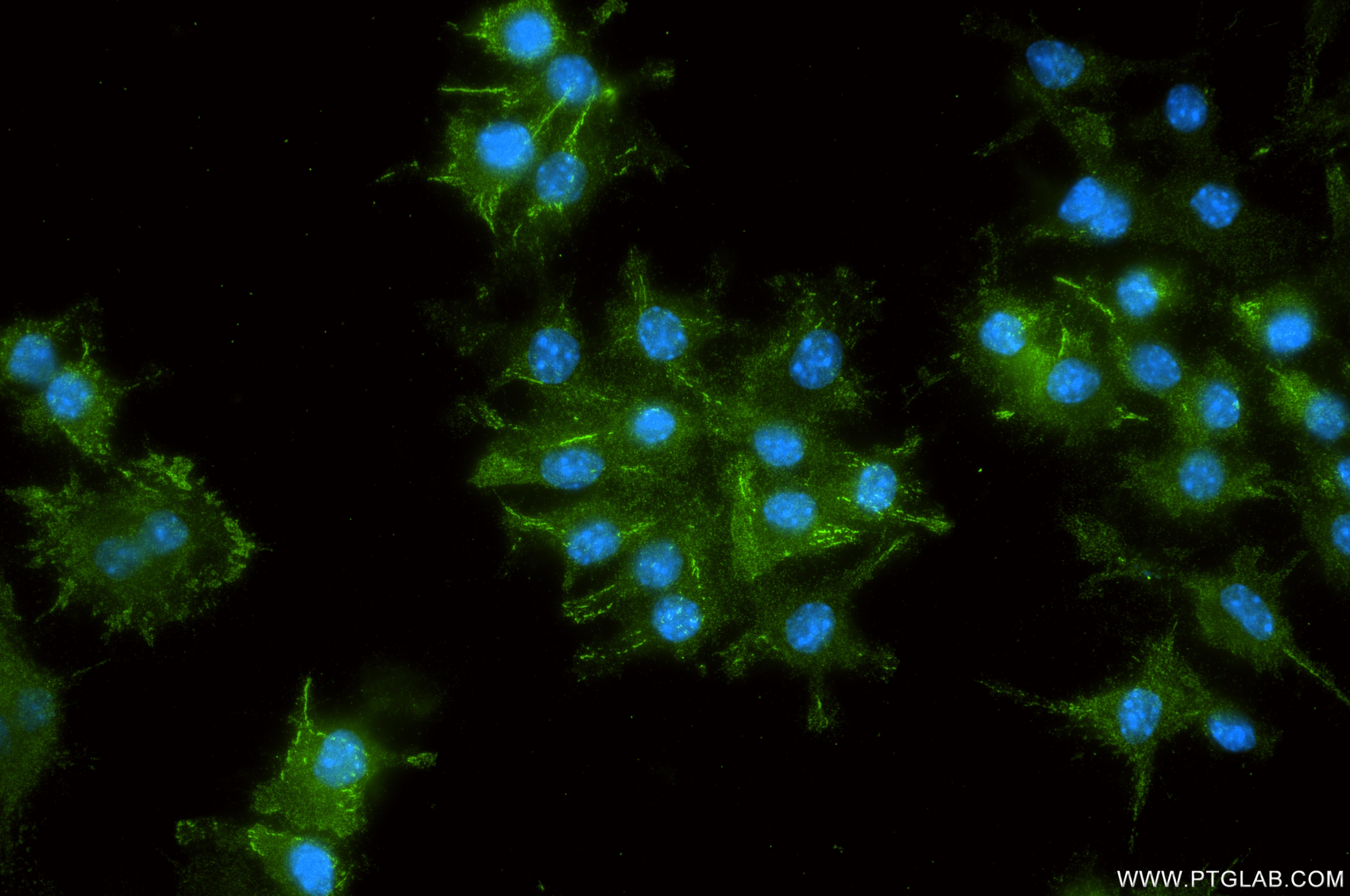 Immunofluorescence (IF) / fluorescent staining of RAW 264.7 cells using Integrin beta 5 Recombinant monoclonal antibody (87465-1-RR)