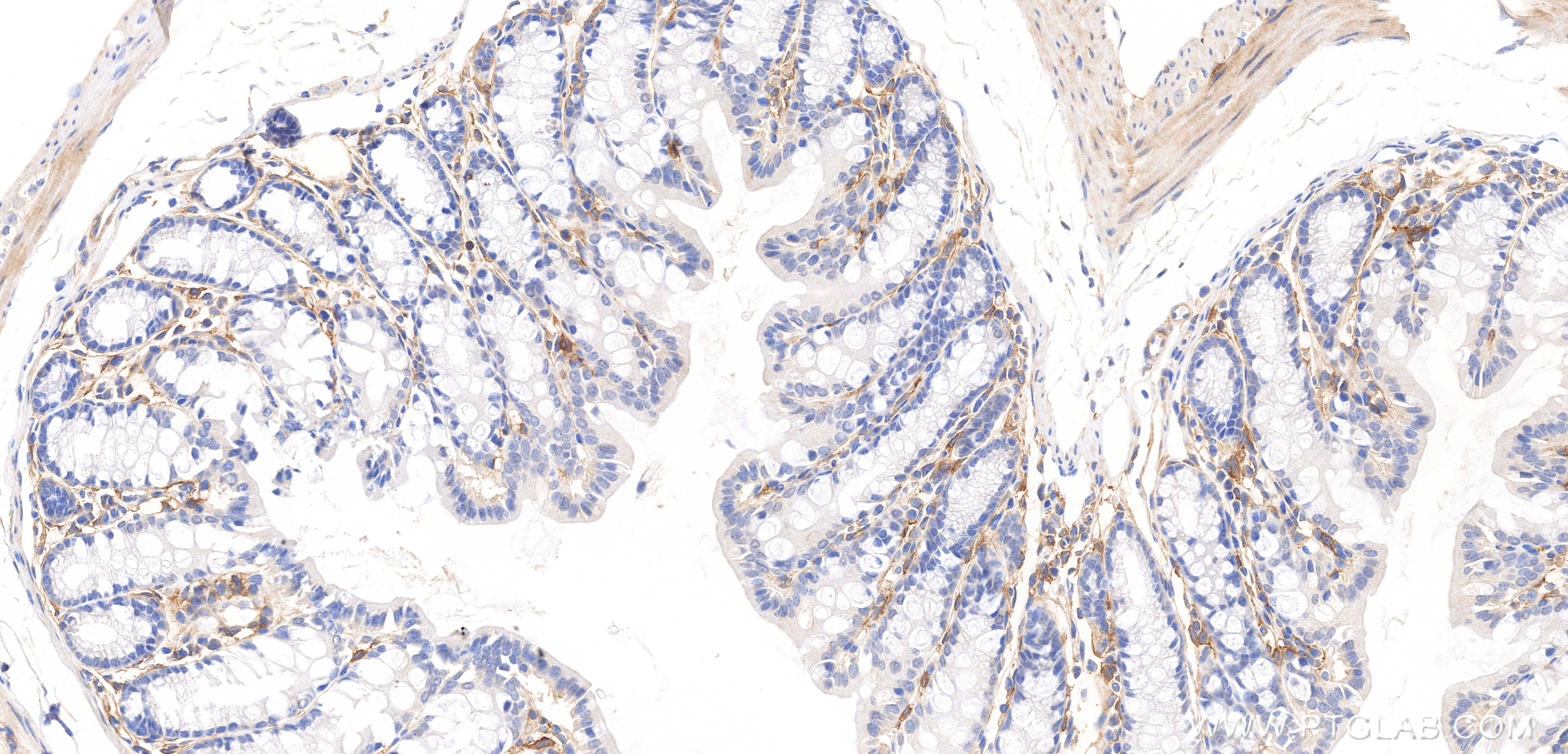 Immunohistochemistry (IHC) staining of mouse colon tissue using Integrin beta 5 Recombinant monoclonal antibody (87465-1-RR)