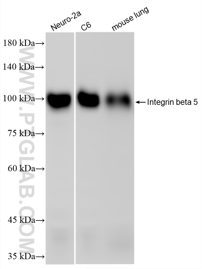 Western Blot (WB) analysis of various lysates using Integrin beta 5 Recombinant monoclonal antibody (87465-1-RR)