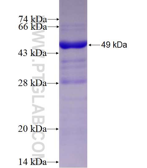 Integrin beta-5 fusion protein Ag25509 SDS-PAGE