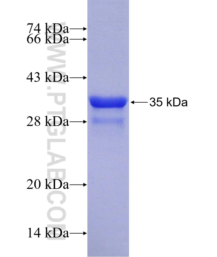 Integrin beta-5 fusion protein Ag29783 SDS-PAGE