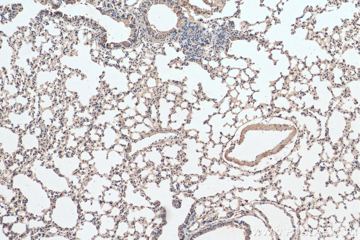 Immunohistochemistry (IHC) staining of mouse lung tissue using Integrin beta-6 Polyclonal antibody (28378-1-AP)