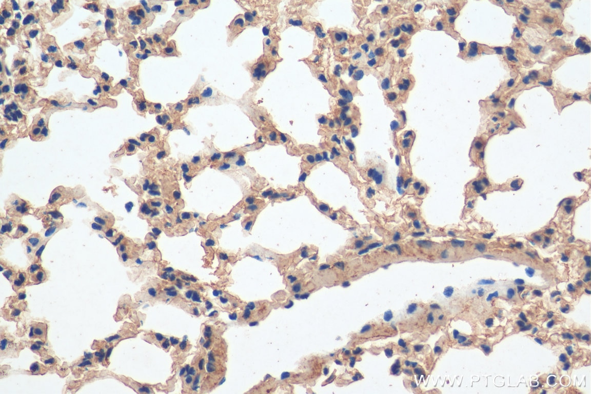 Immunohistochemistry (IHC) staining of mouse lung tissue using Integrin beta-6 Polyclonal antibody (28378-1-AP)